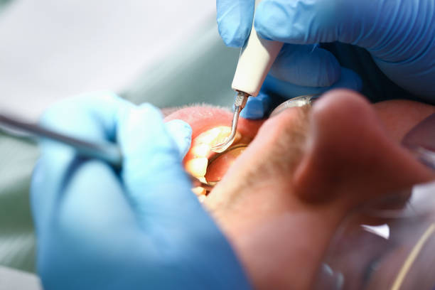 Best Knocked-Out Tooth Emergency  in Candor, NC